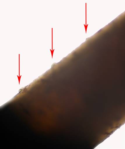 Protuberancias cuticulares características del género Ochoterenella, localizadas en la región media del cuerpo del
nematodo Ochoterenella sp. (MECN-SIN-001), encontrado adherido a la pared inferior del estómago de
un Rhinella horribilis.