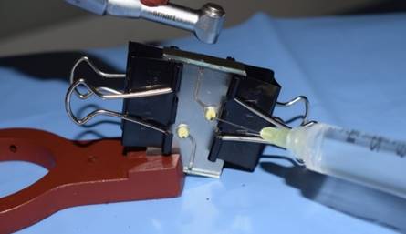 Figura #4.